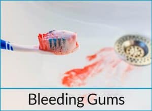 gum-disease-treatment-problems-bleeding-gums